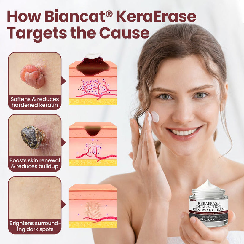 KeraErase® Dual-Action Renewal Cream( Buy 1 Get 2 Free)