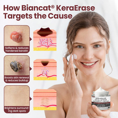 KeraErase® Dual-Action Renewal Cream( Buy 1 Get 2 Free)