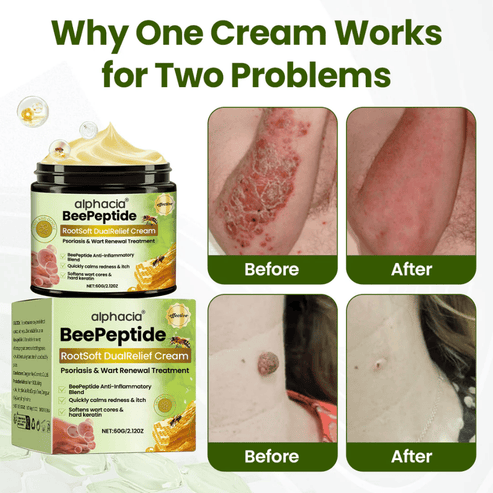 BeePeptide RootSoft DualRelief Cream⚕️ ( Buy 1 Get 1 Free)